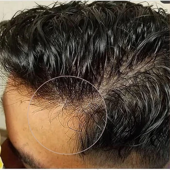 Инжектиране на Трайни Полнокожный Перука от Изкуствена Кожа На Базата На Мъжките Коса, Вълнообразни Протеза От Човешки Косъм, Естествена Линия на Растеж на Косата, Черен Цвят, изкуствена коса, Система за Перуки